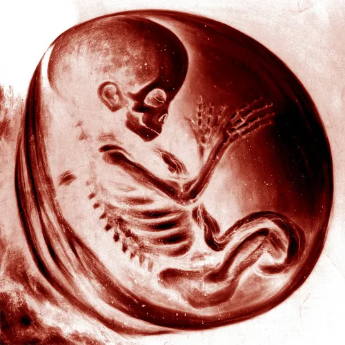 Embryodead